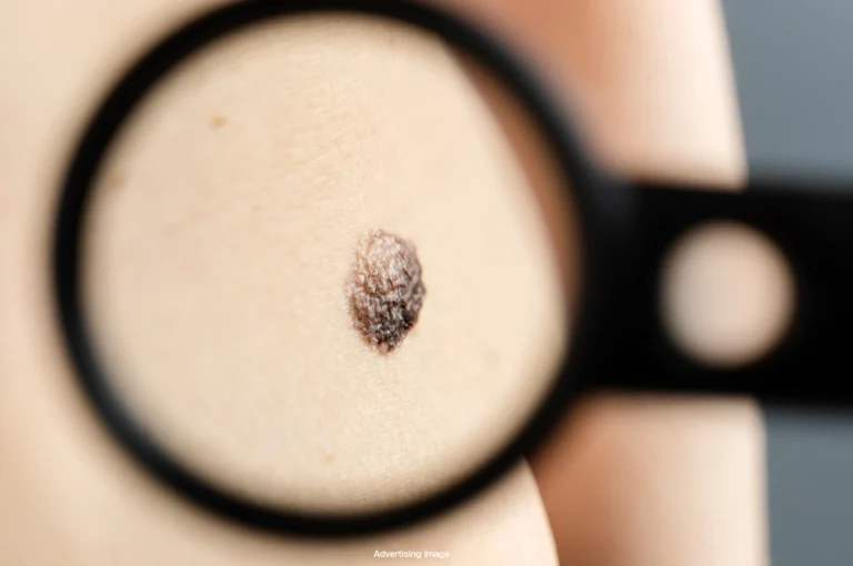 Banner mole