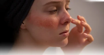 Cosmetic Skin Allergies