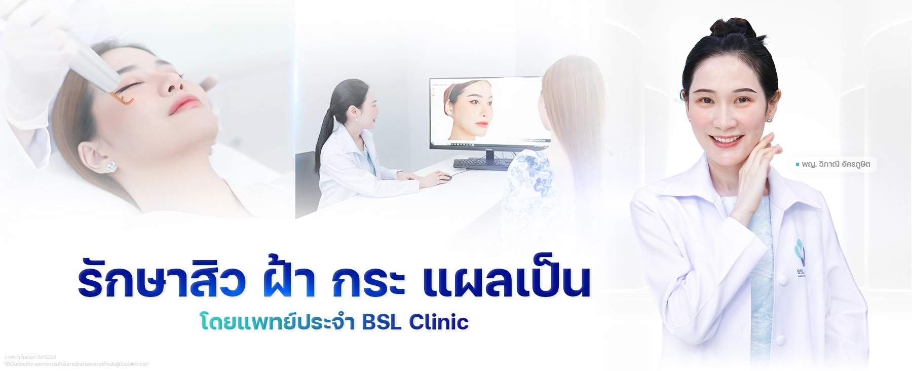 รักษาสิว-ฝ้า-กระ-แผลเป็น