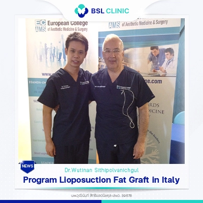 Lioposuction Fat Graft in Italy
