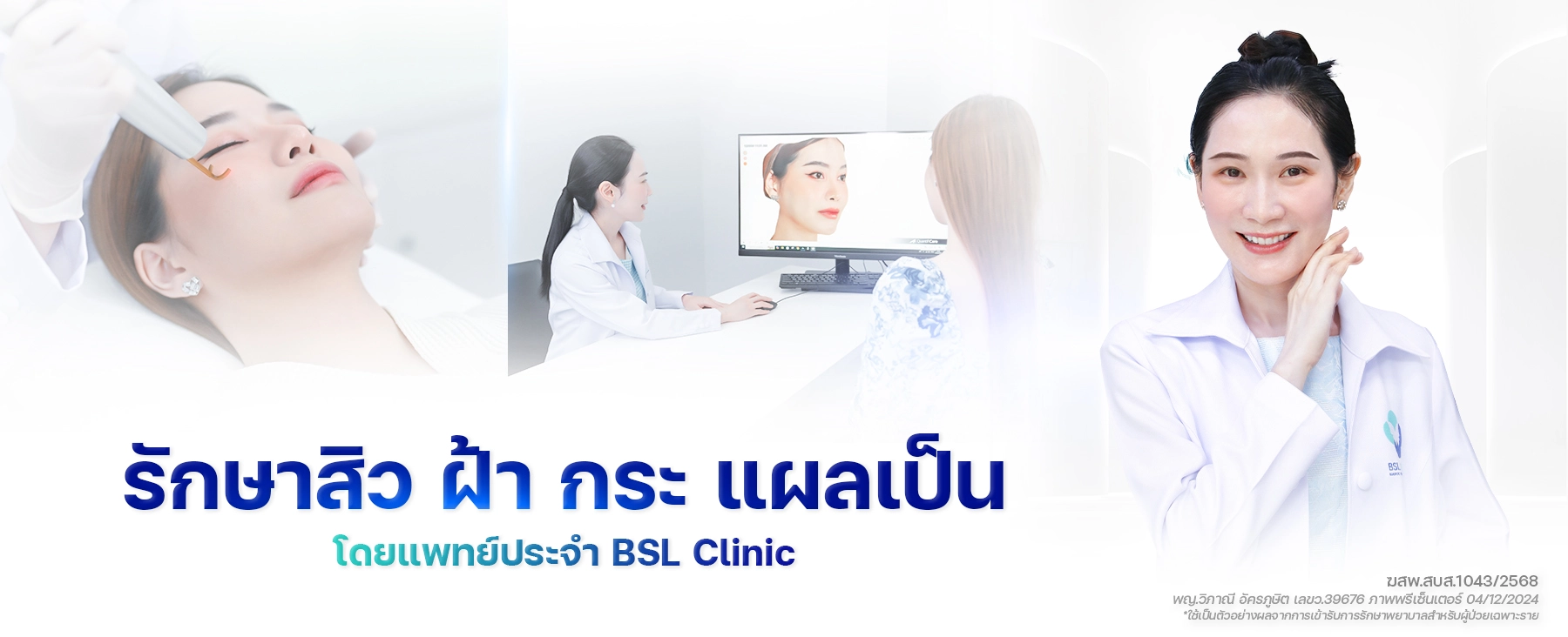 รักษาสิว-ฝ้า-กระ-แผลเป็น