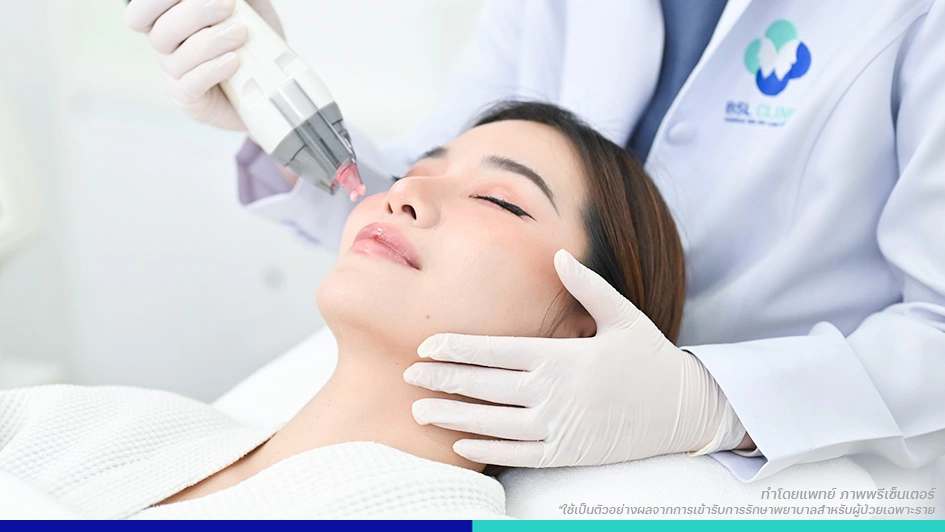 รักษาสิว