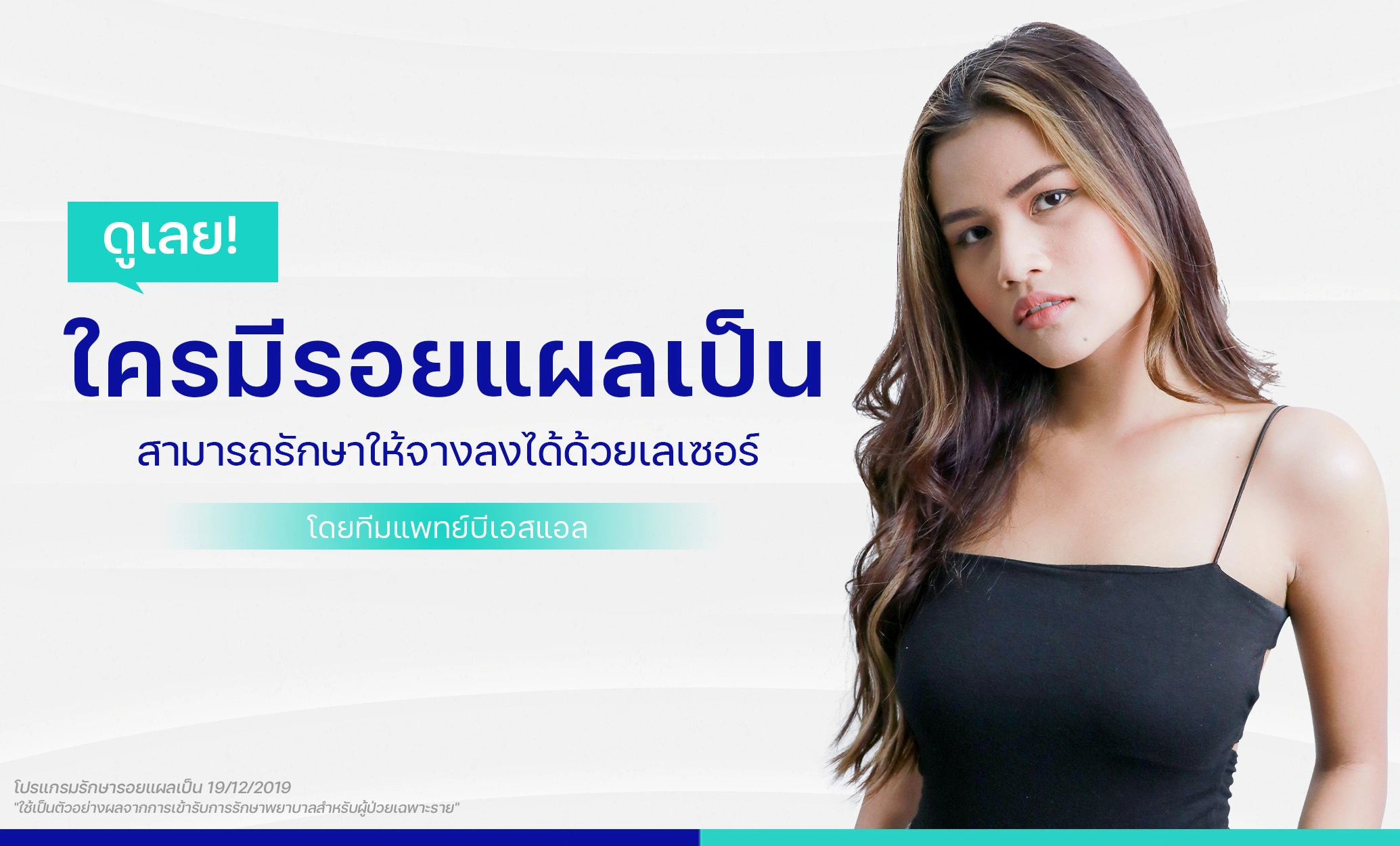 เลเซอร์แผลเป็น