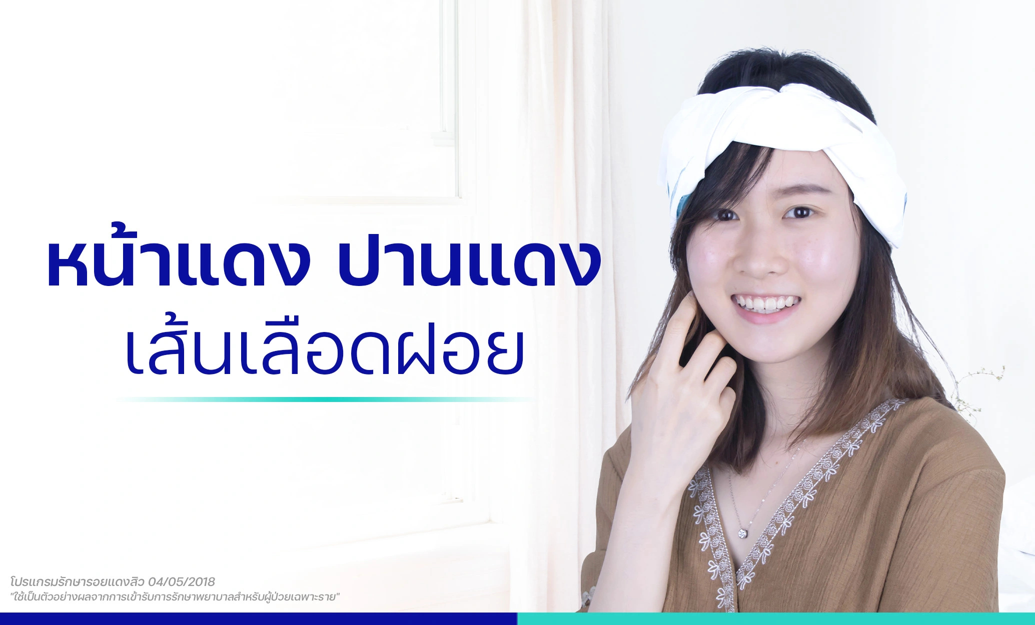 โปรแกรมรักษาเส้นเลือดฝอย ปานแดง หน้าแดง