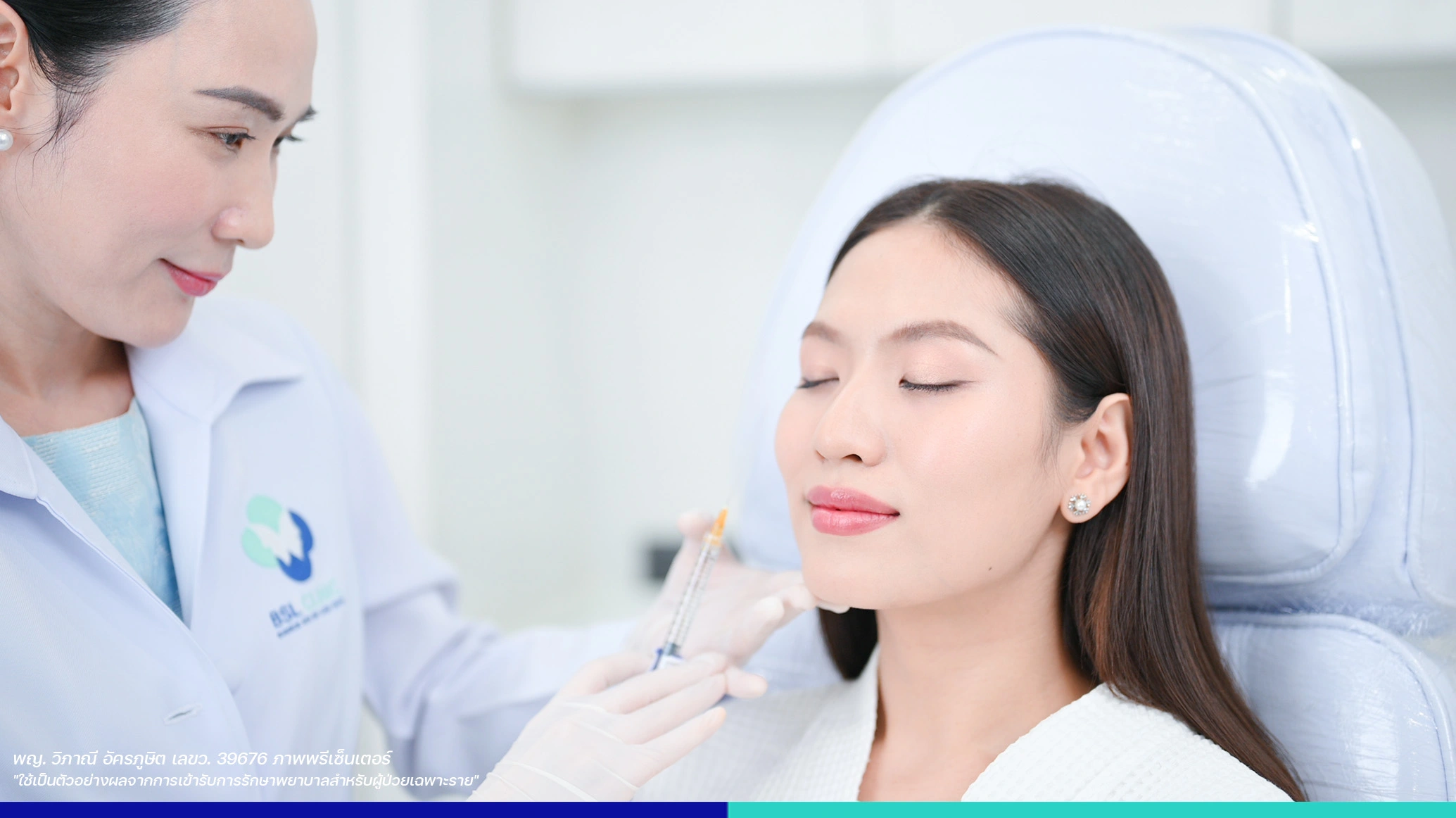 filler ผลการรักษารอยแผลเป็น