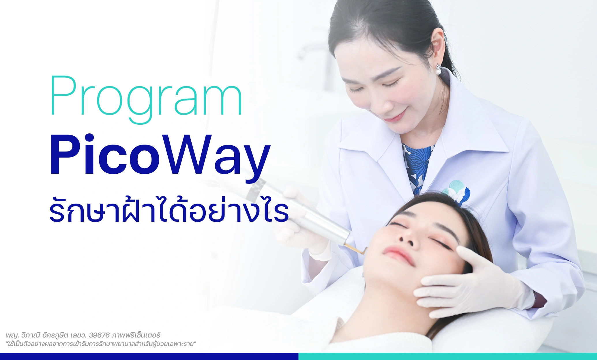 picoway รักษาฝ้าได้อย่างไร