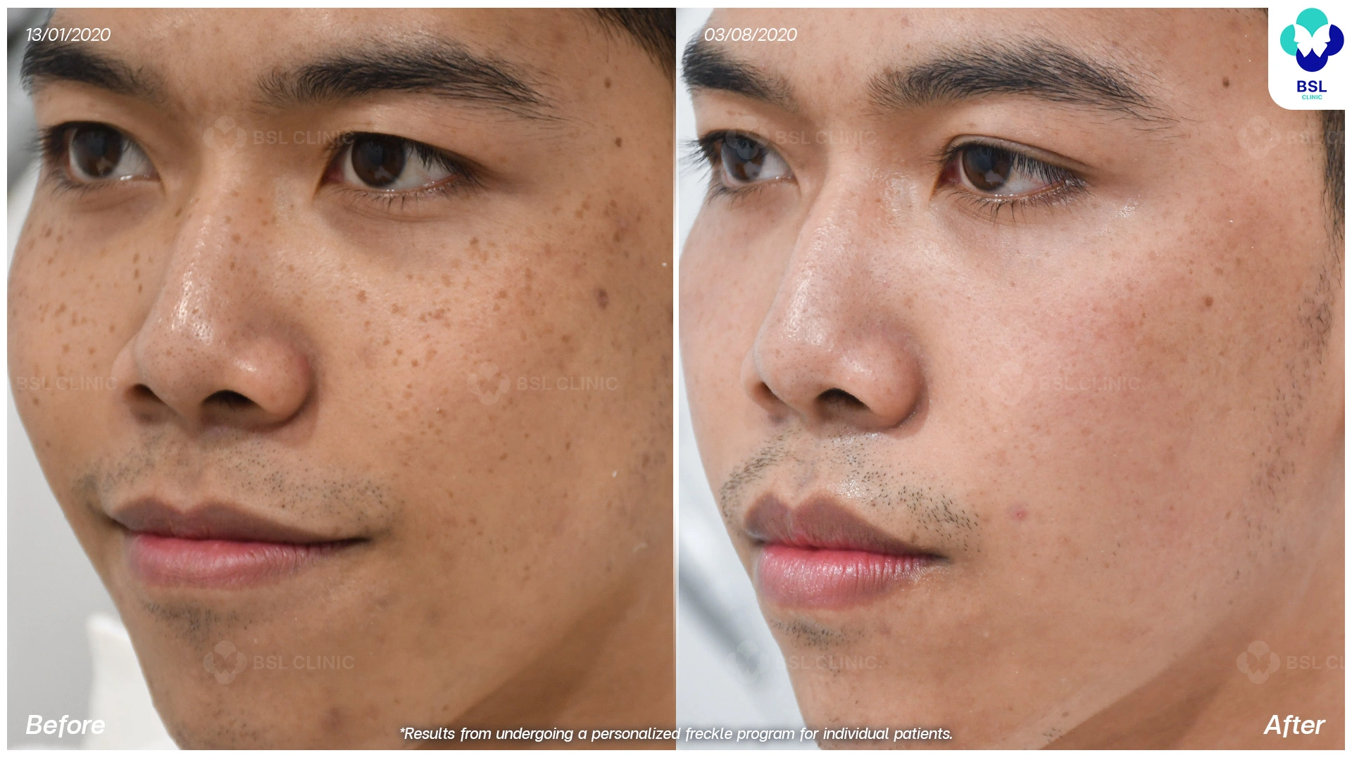 รักษากระผู้ชาย