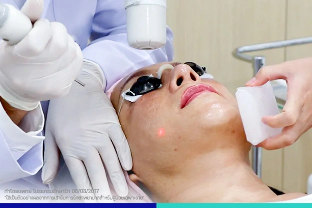 ขั้นตอนการรักษา เลเซอร์ลดเม็ดสี