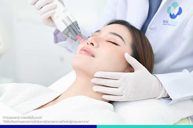 ขั้นตอนการรักษา เลเซอร์ดึงเม็ดสี