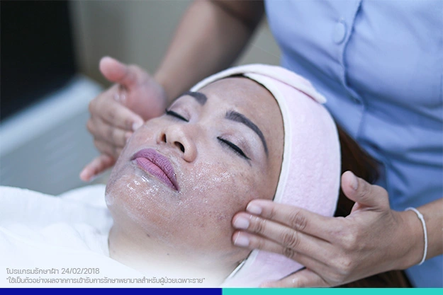 ขั้นตอนการรักษา ผลิตภัณฑ์รักษาฝ้า