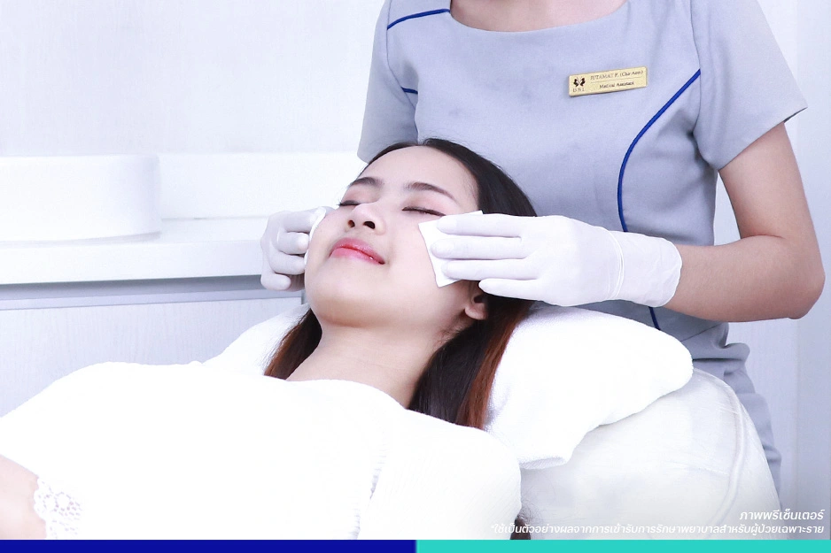 กดสิว คลีนหน้า