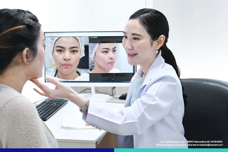 ปรึกษาให้คำแนะนำเรื่องสิว