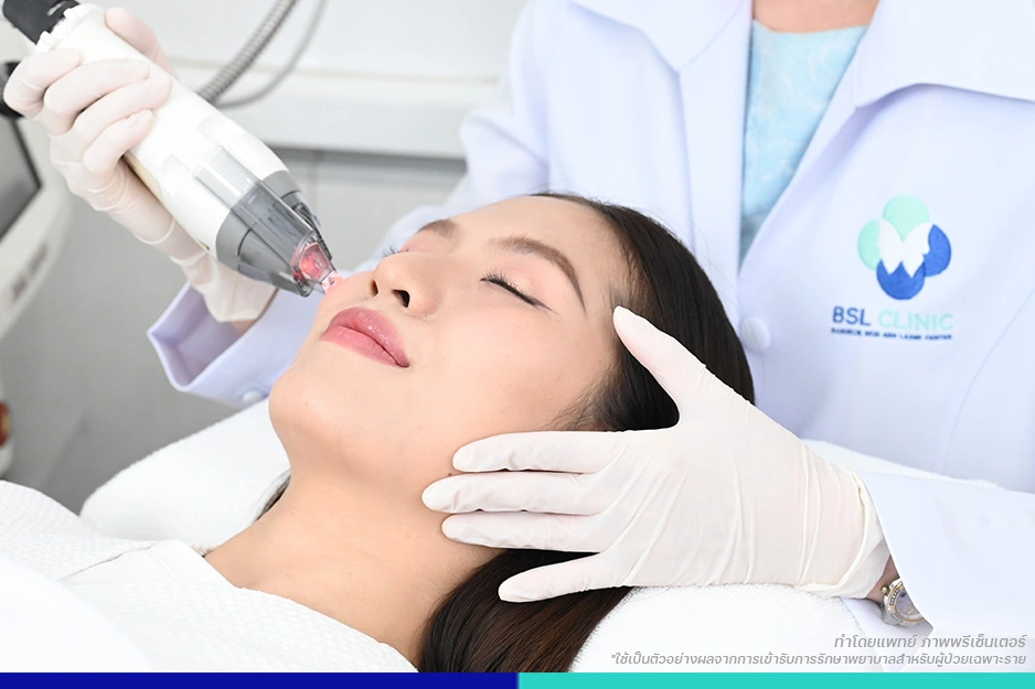 คลินิกรักษาสิว