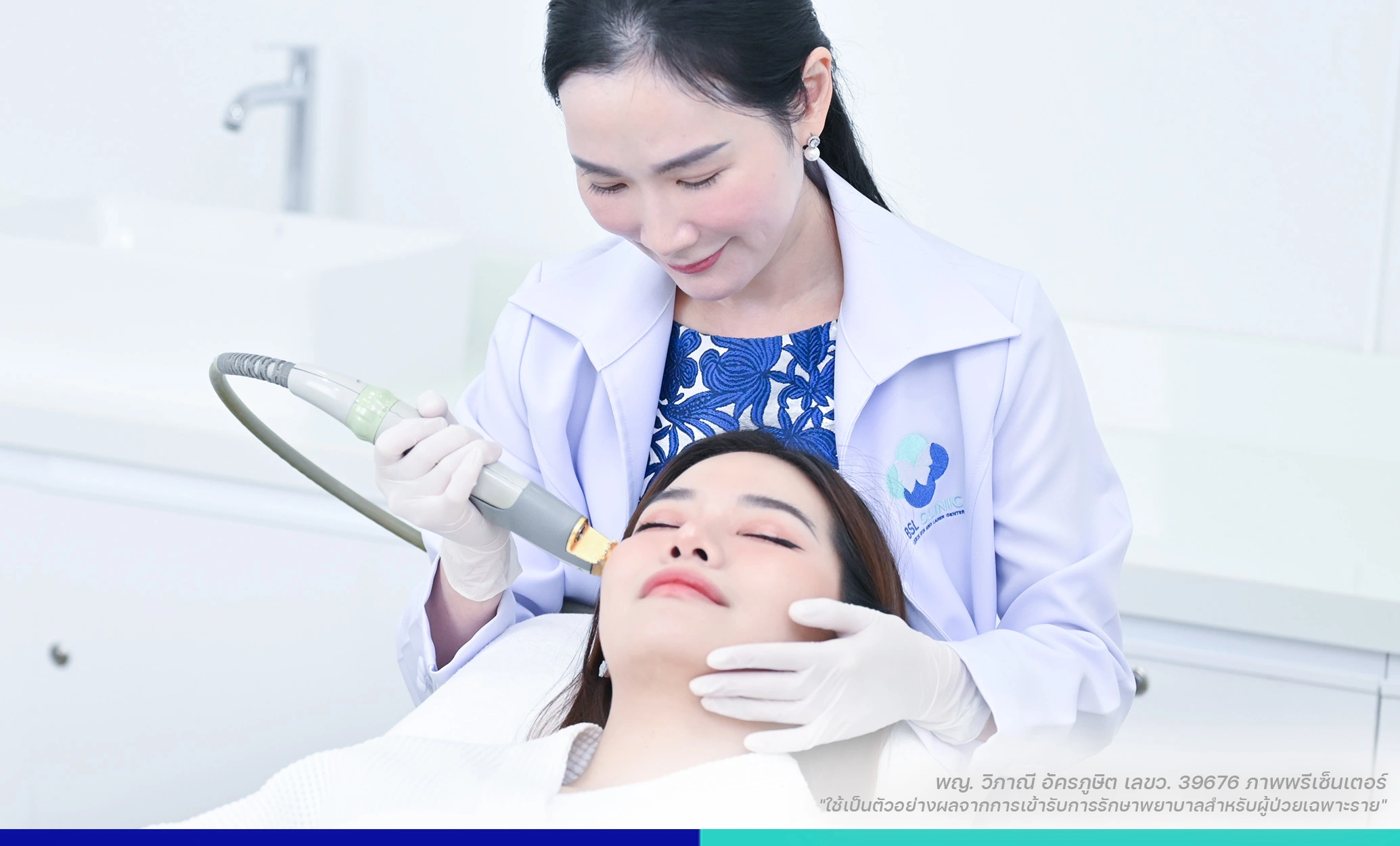 เลเซอร์รอยแดง รักษาผิวแพ้ง่าย