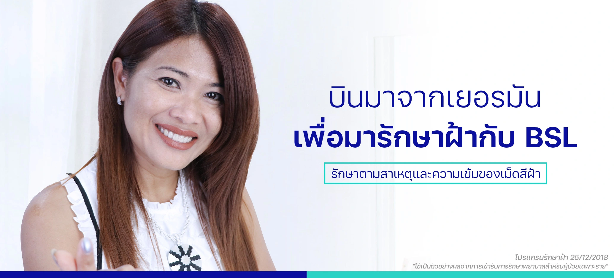 รีวิวรักษาฝ้าบินข้ามประเทศ