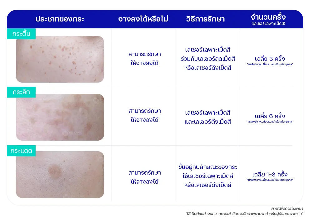 วิธีรักษากระแต่ละประเภท