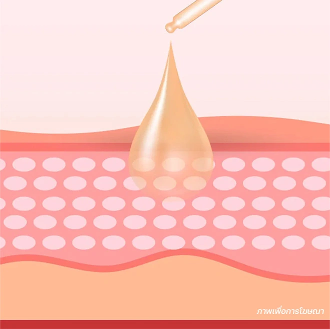 วิธีรักษาฝ้า ผลิตภัณฑ์รักษาฝ้า