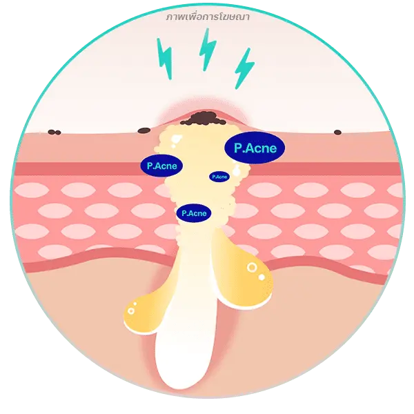 เชื้อแบคทีเรีย