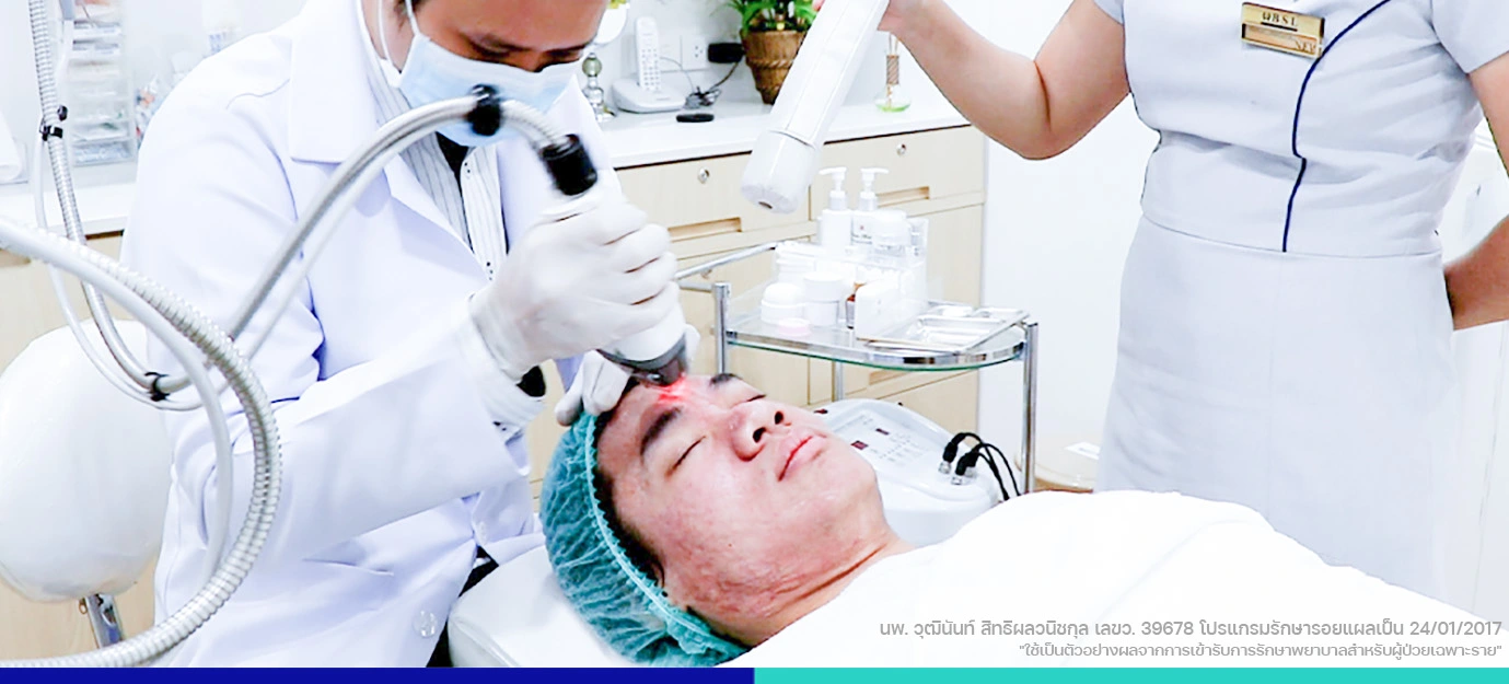 หลุมสิว รอยแผลเป็นจากสิว