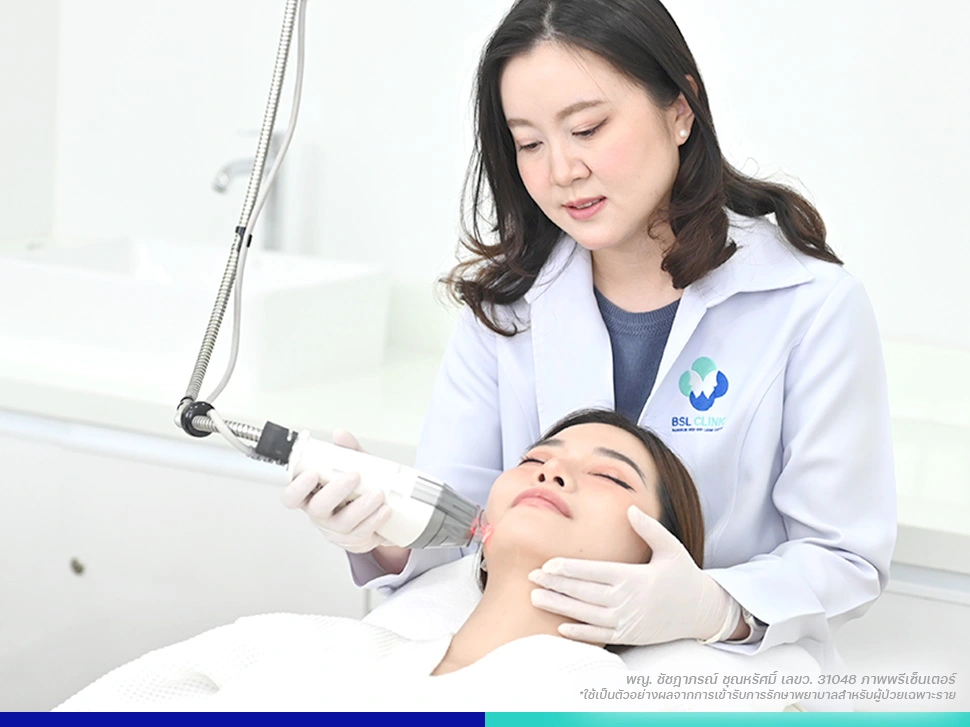 เลเซอร์รักษาสิว