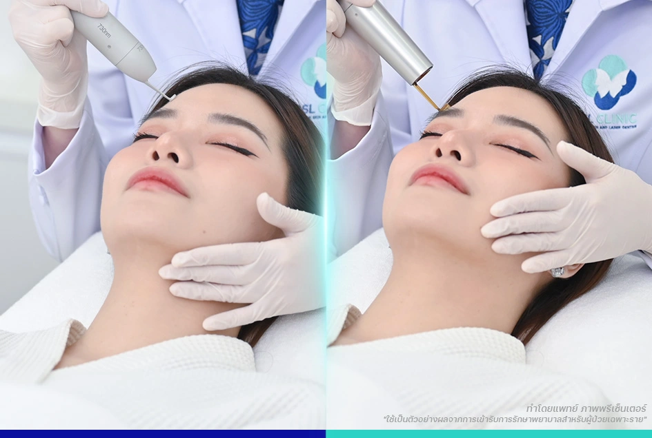 โปรแกรมPicoway