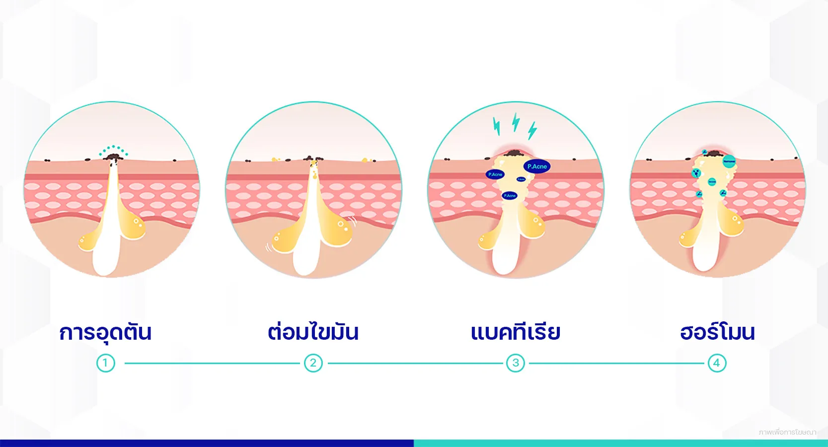 สาเหตุสิวอุดตันจากแมส