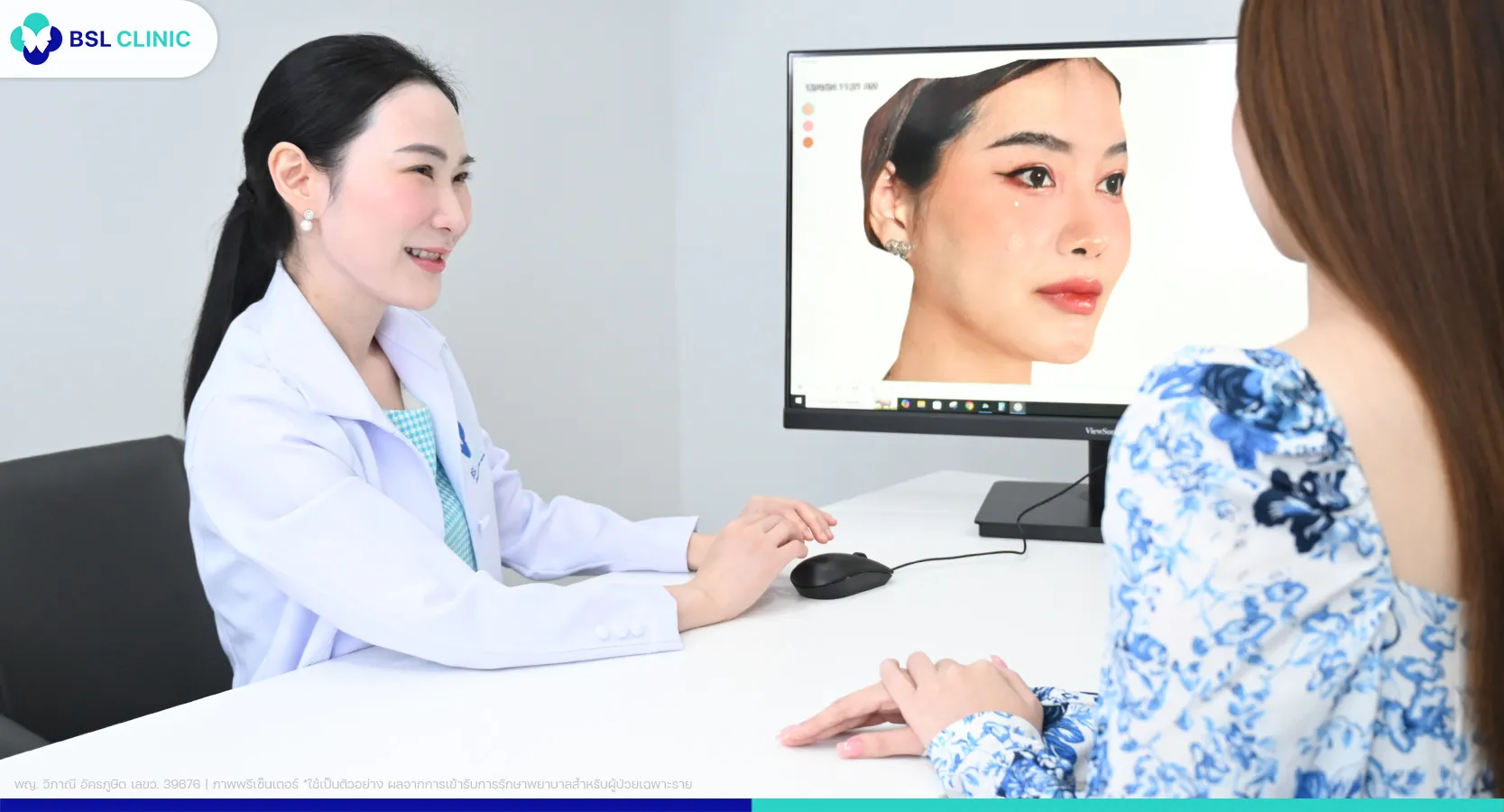 สิวขึ้นคาง