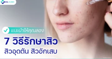 วิธีรักษาสิวอุดตัน