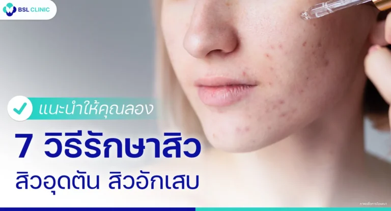 วิธีรักษาสิวอุดตัน