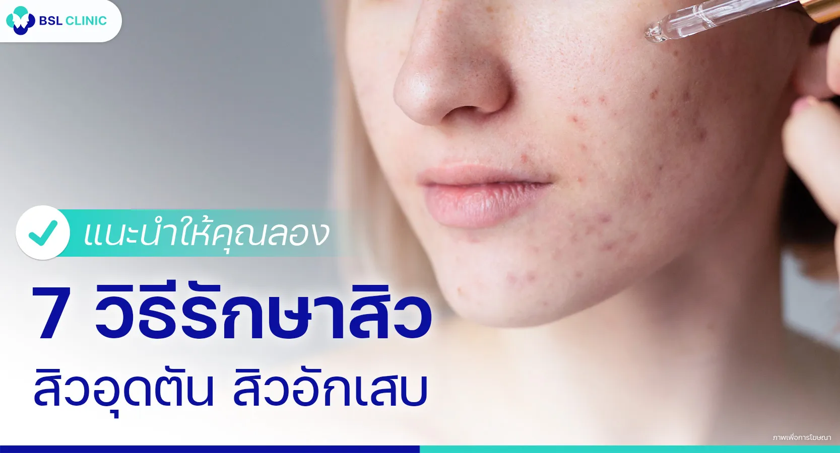 รักษาสิวอุดตัน