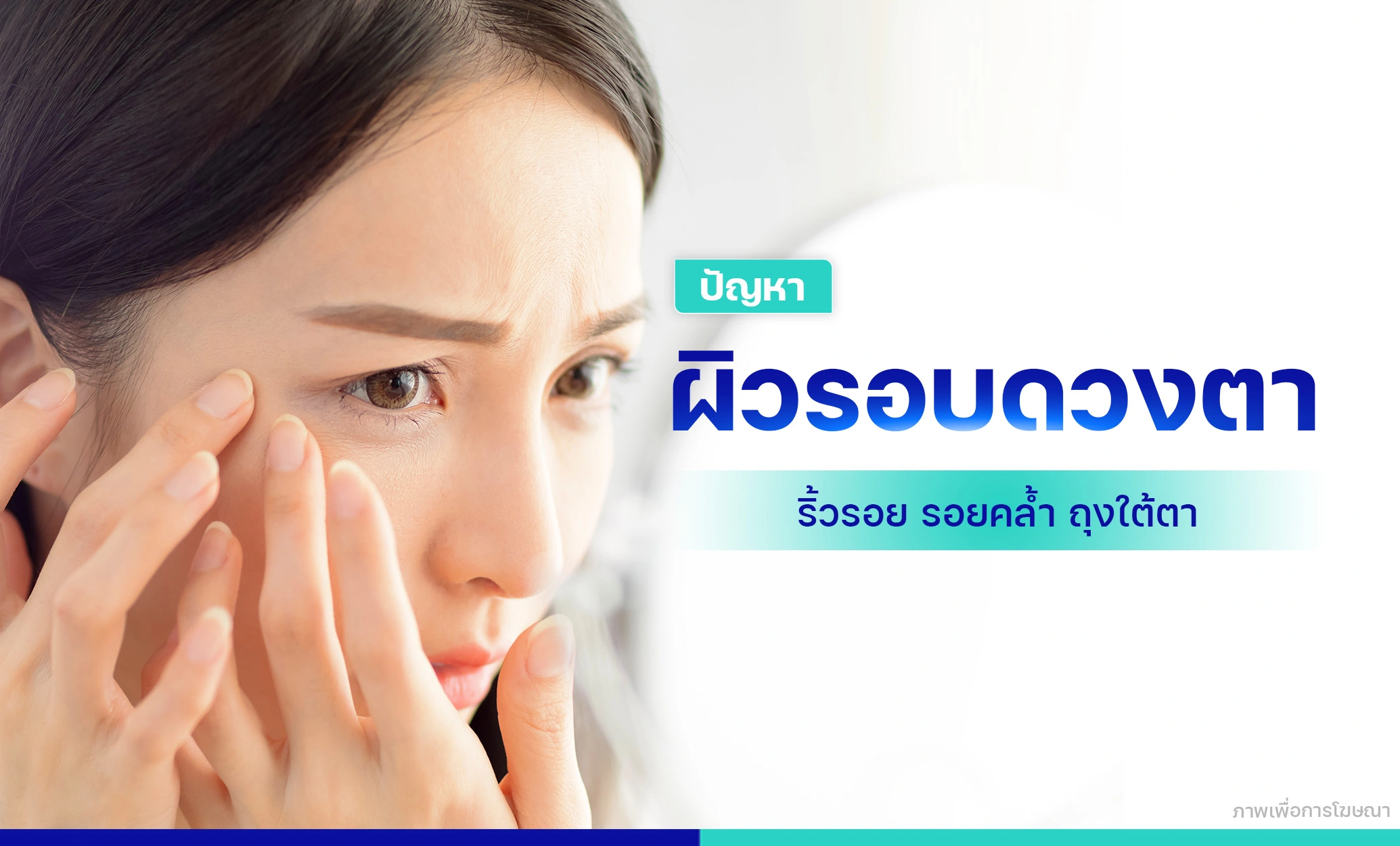 เลเซอร์ผิวรอบดวงตา