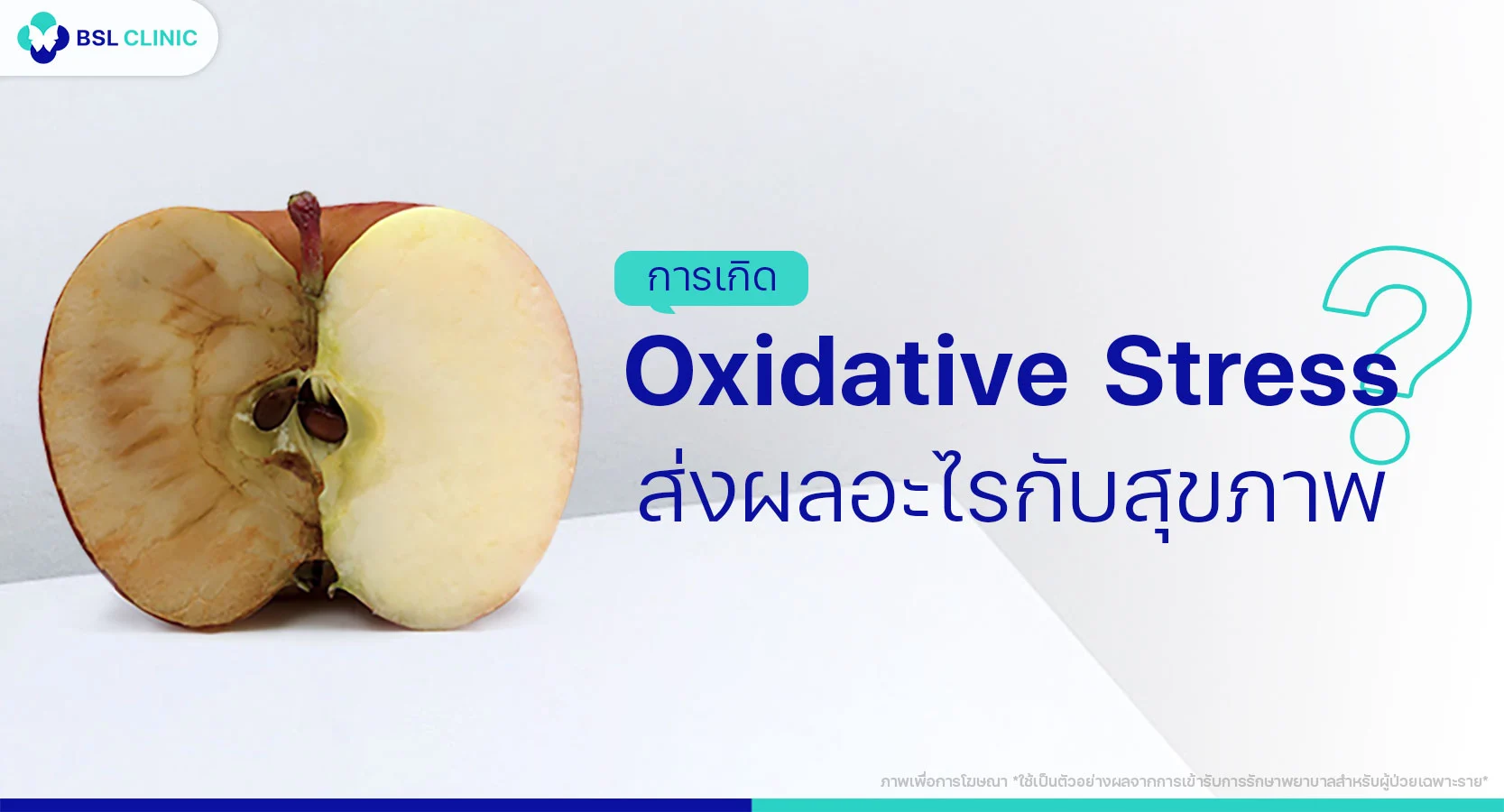 Oxidative Stress คือ