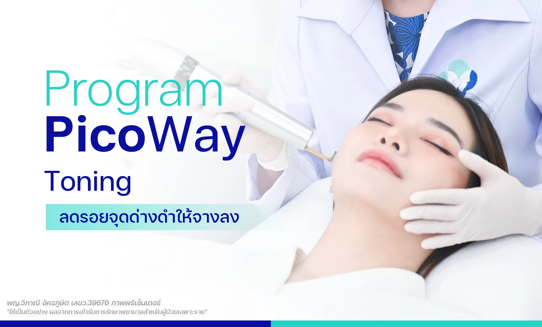PicoWay toning ลดรอยจุดด่างดำ