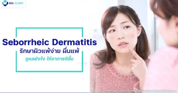 รักษาผิวแพ้ง่าย