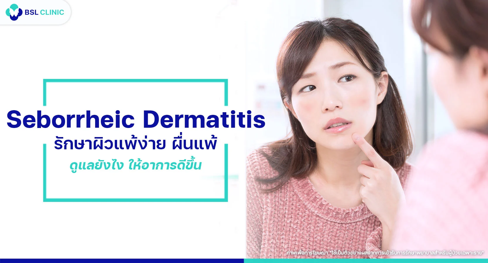 รักษาผิวแพ้ง่าย