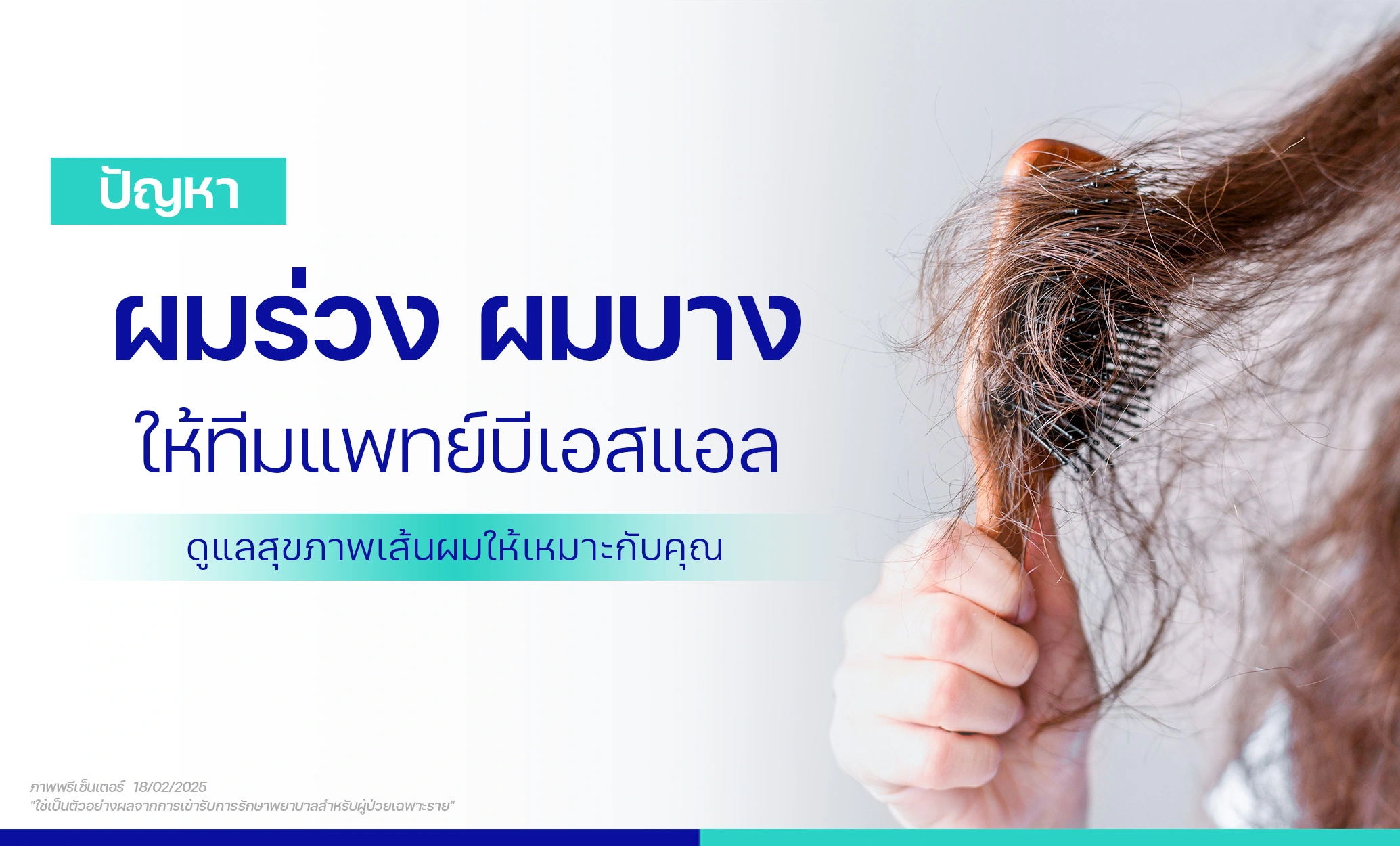 ผมร่วง ผมบาง ศีรษะล้าน