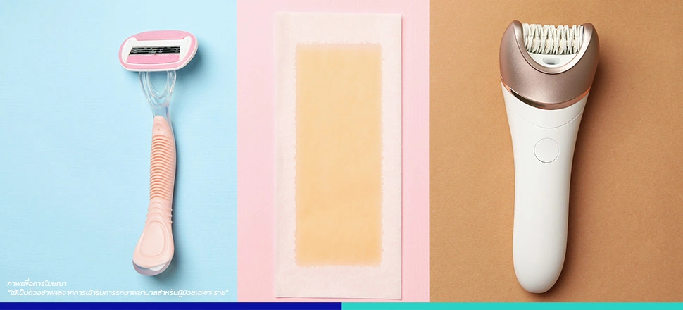 เลเซอร์กำจัดขน