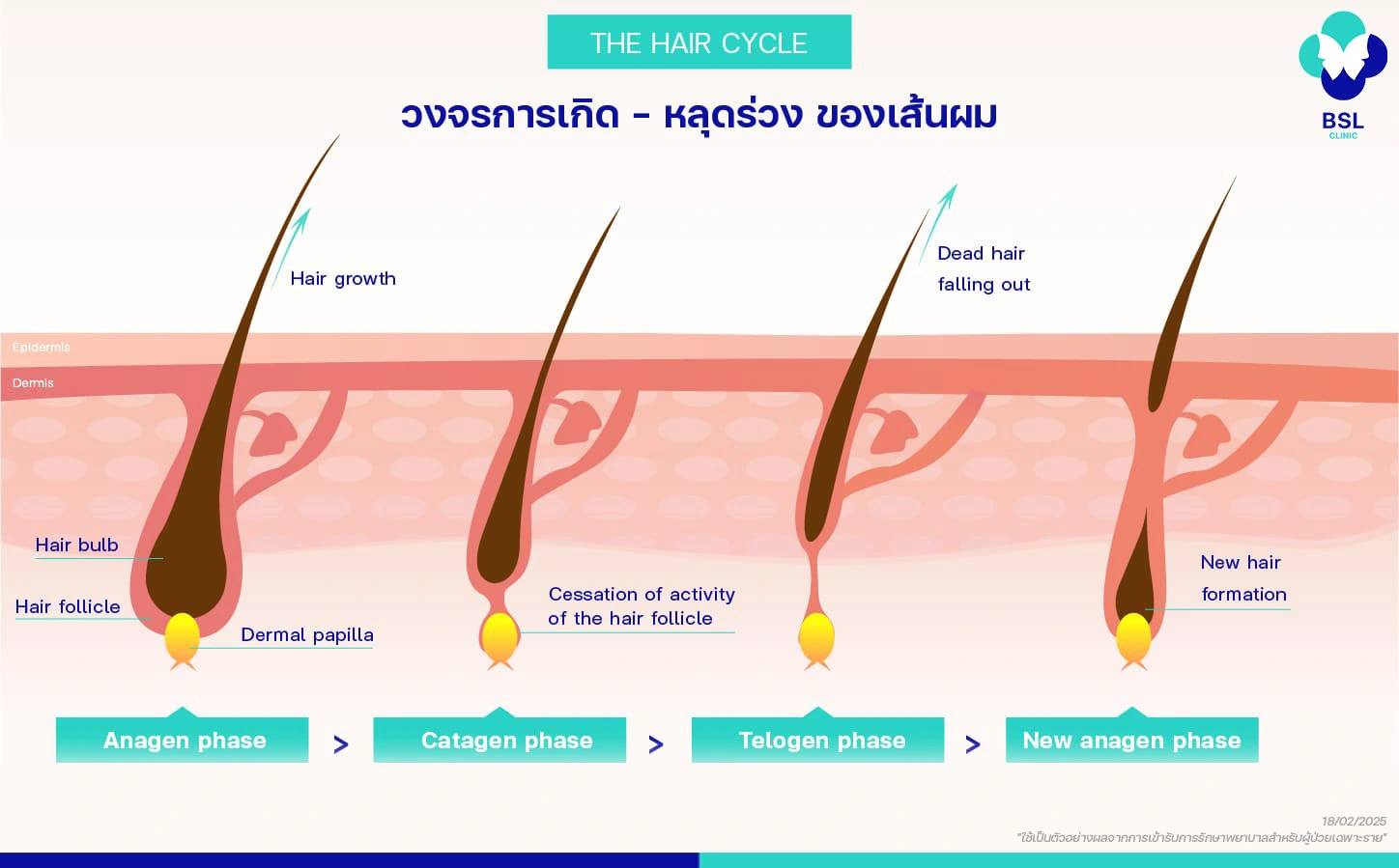 ผมร่วง ผมบาง ศีรษะล้าน