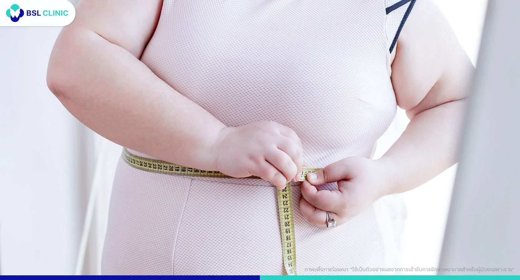 เตรียมตัวก่อนดูดไขมัน