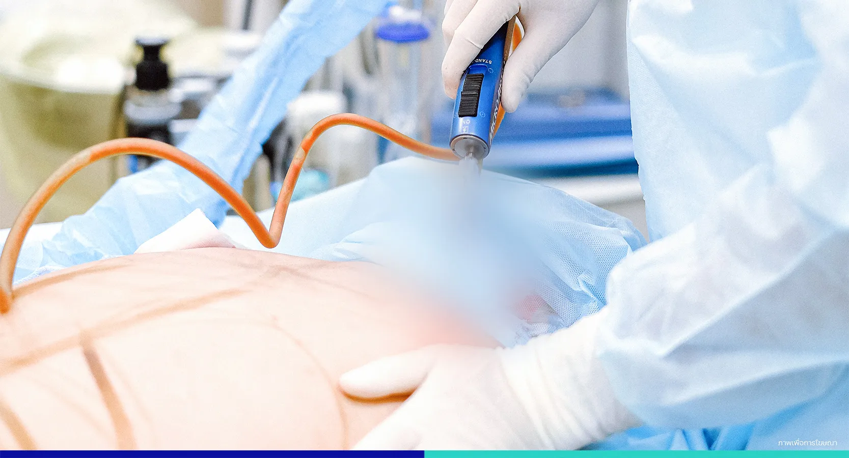 ดูดไขมัน