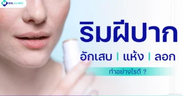 ริมฝีปากอักเสบ