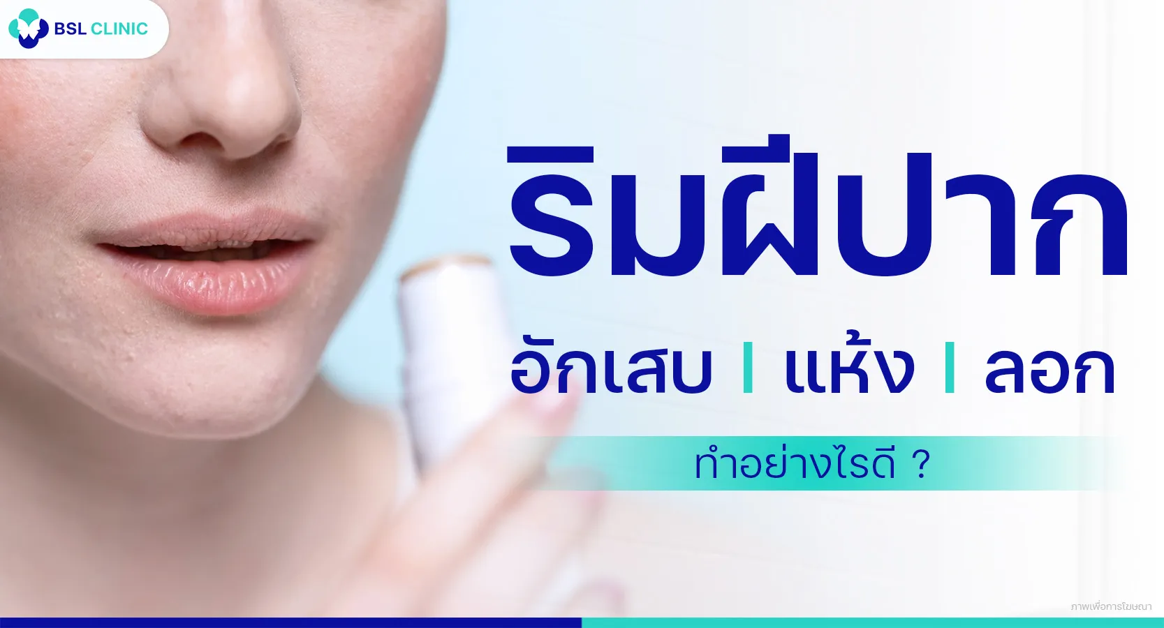 ริมฝีปากอักเสบ