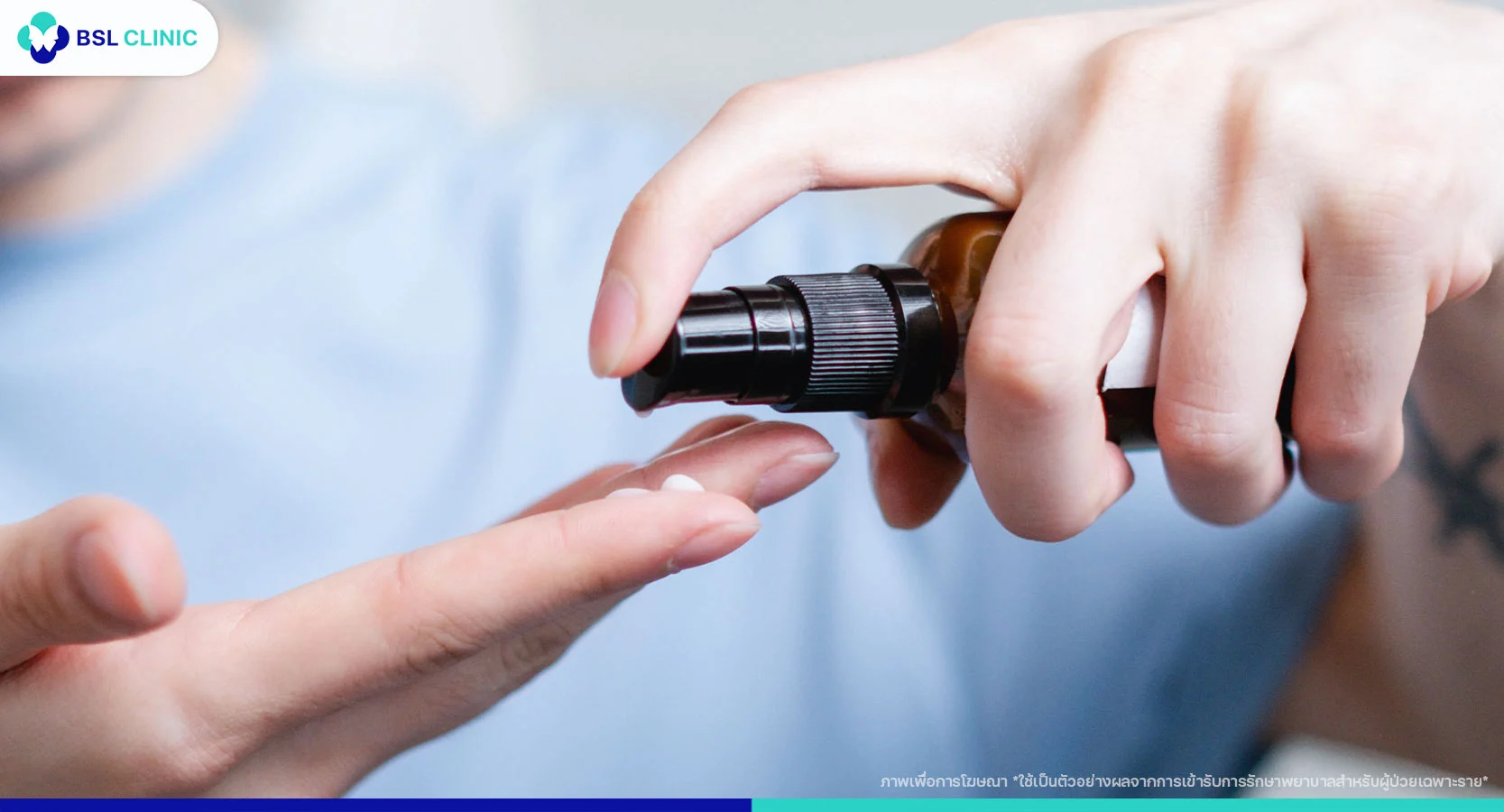 การรักษา Seborrheic Dermatitis