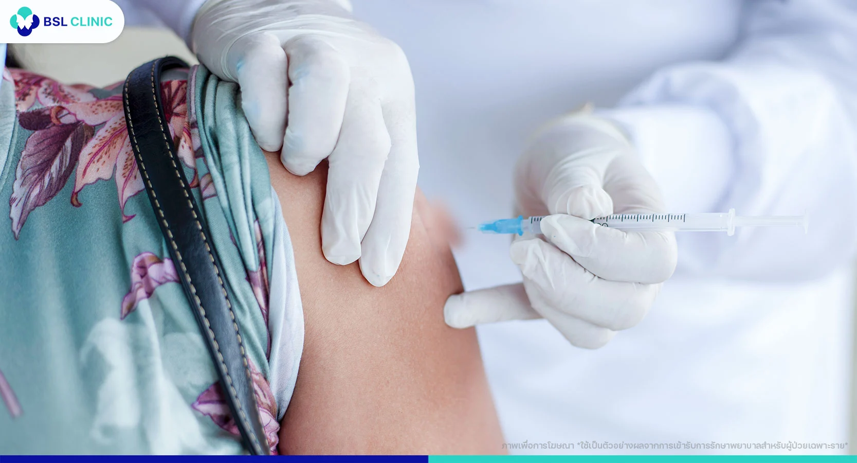 การรักษาอีสุกอีใส