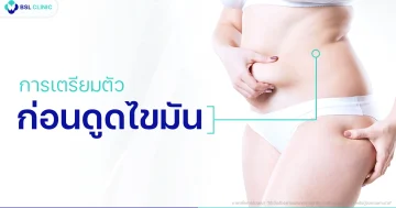 ดูดไขมัน
