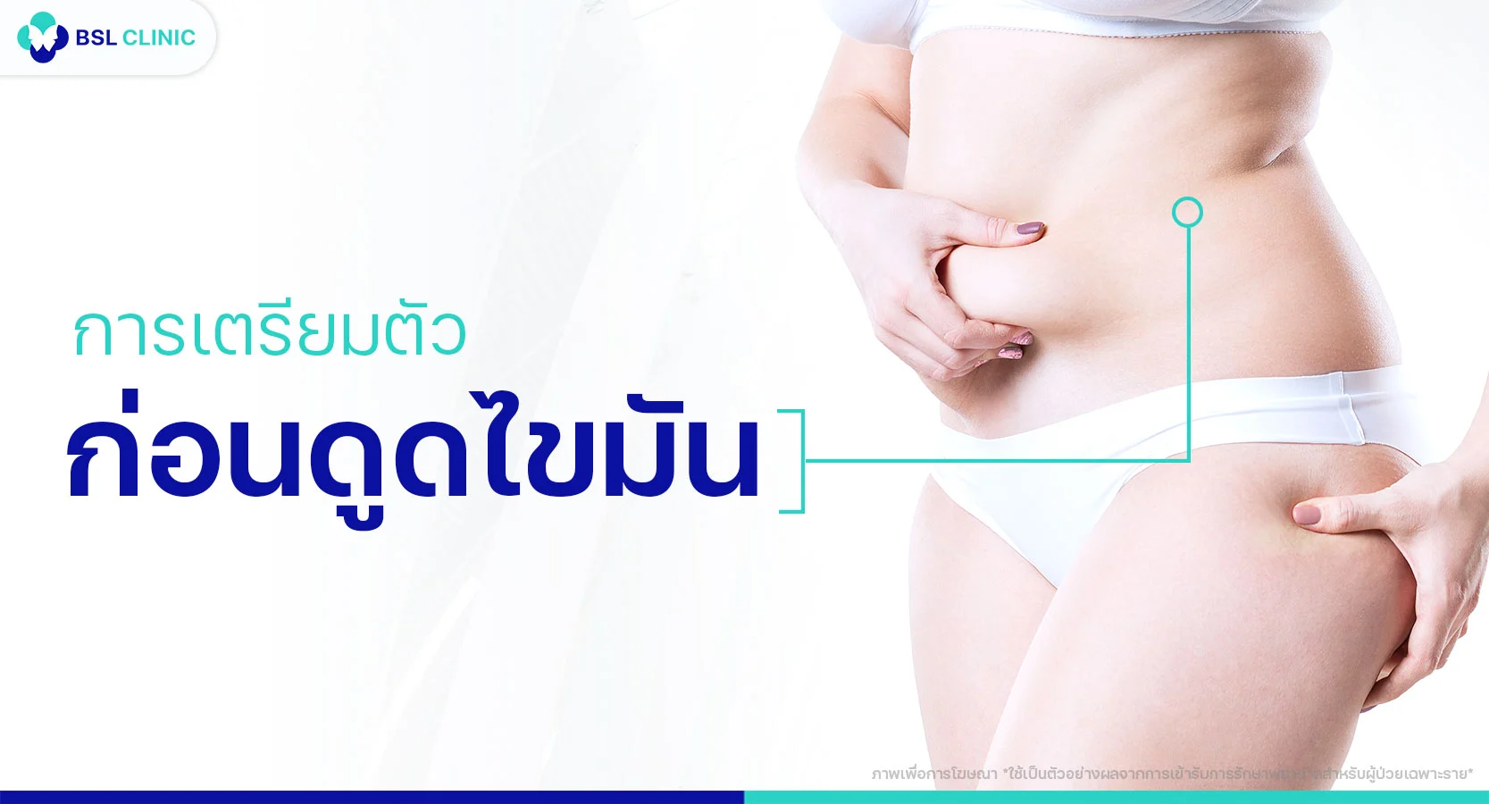 ดูดไขมัน