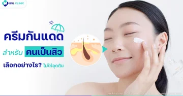 ครีมกันแดดสำหรับคนเป็นสิว