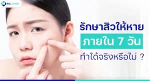 คลินิกรักษาสิวที่ไหนดี