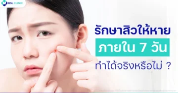 คลินิกรักษาสิวที่ไหนดี