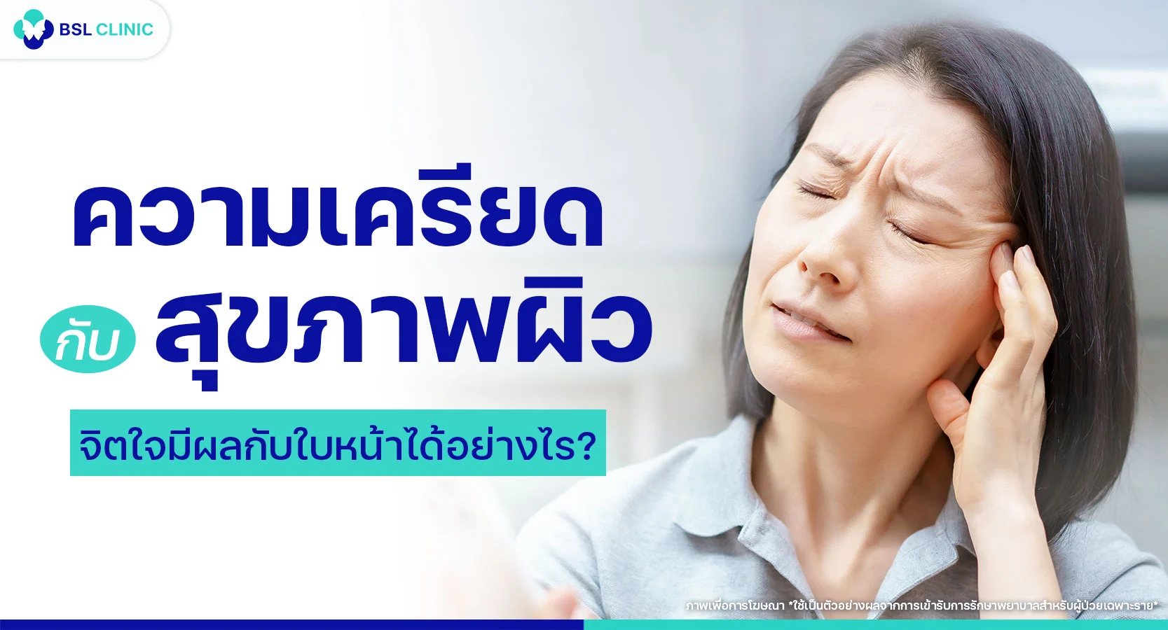 ความเครียดกับสุขภาพผิว